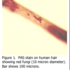 Pas Stain on Human Hair