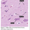 H&E Stain of Normal Brain Tissue