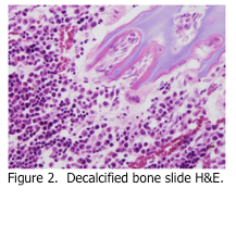 Decalcified bone slide