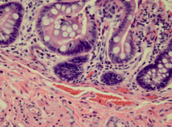 Troubleshooting Histology: Double Barrel Style – H&E and Special Stains Image 1