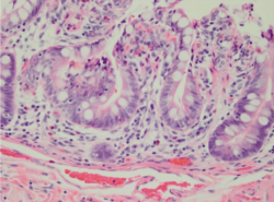 Troubleshooting Histology: Double Barrel Style – H&E and Special Stains Image 2