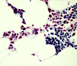 Troubleshooting Histology: Double Barrel Style – H&E and Special Stains Image 3