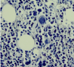 Troubleshooting Histology: Double Barrel Style – H&E and Special Stains Image 4
